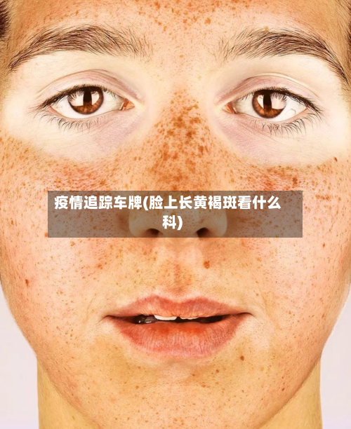 疫情追踪车牌(脸上长黄褐斑看什么科)